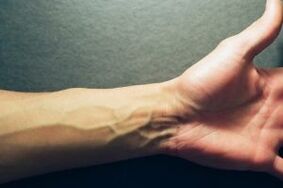 hand