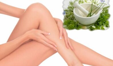 Treatment of varicose veins of the lower extremities with folk remedies