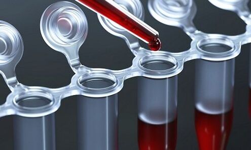 Blood test for varicose veins on the legs