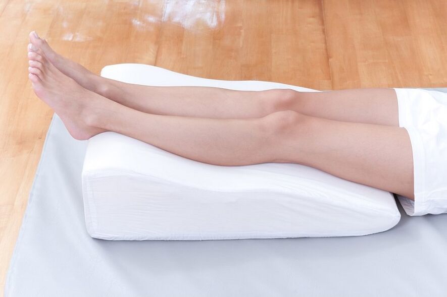 Varicose veins on the legs