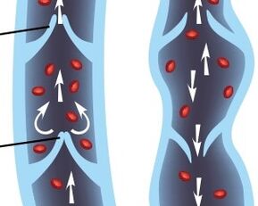 Operation of the valve apparatus of the veins of the lower extremities