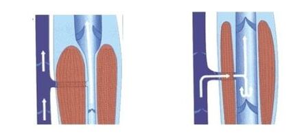 proper functioning of the vein pump