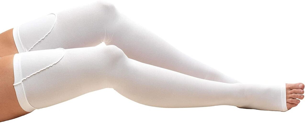 Wearing compression stockings is necessary to treat varicose veins